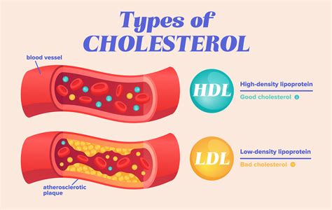 hdl 콜레스테롤 높으면, 우주 여행도 가능할까?